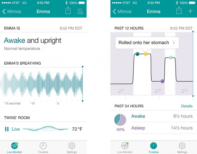 Mimo Smart Baby Monitor