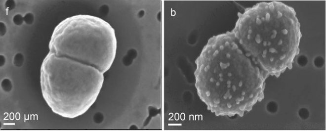 Бактерии Deinococcus radiodurans