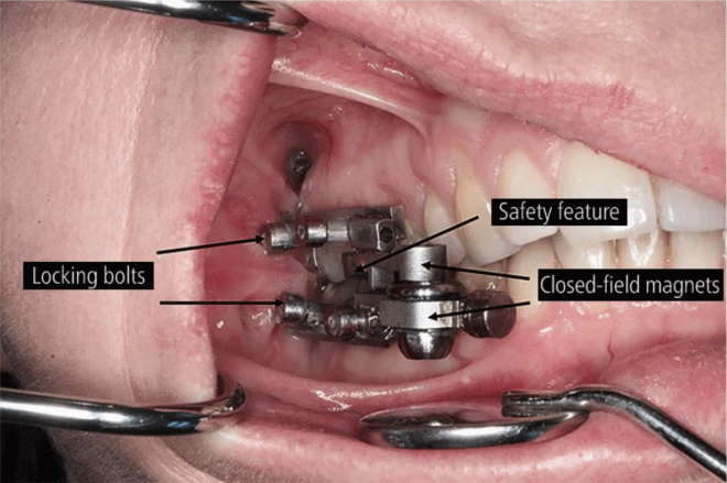 DentalSlim